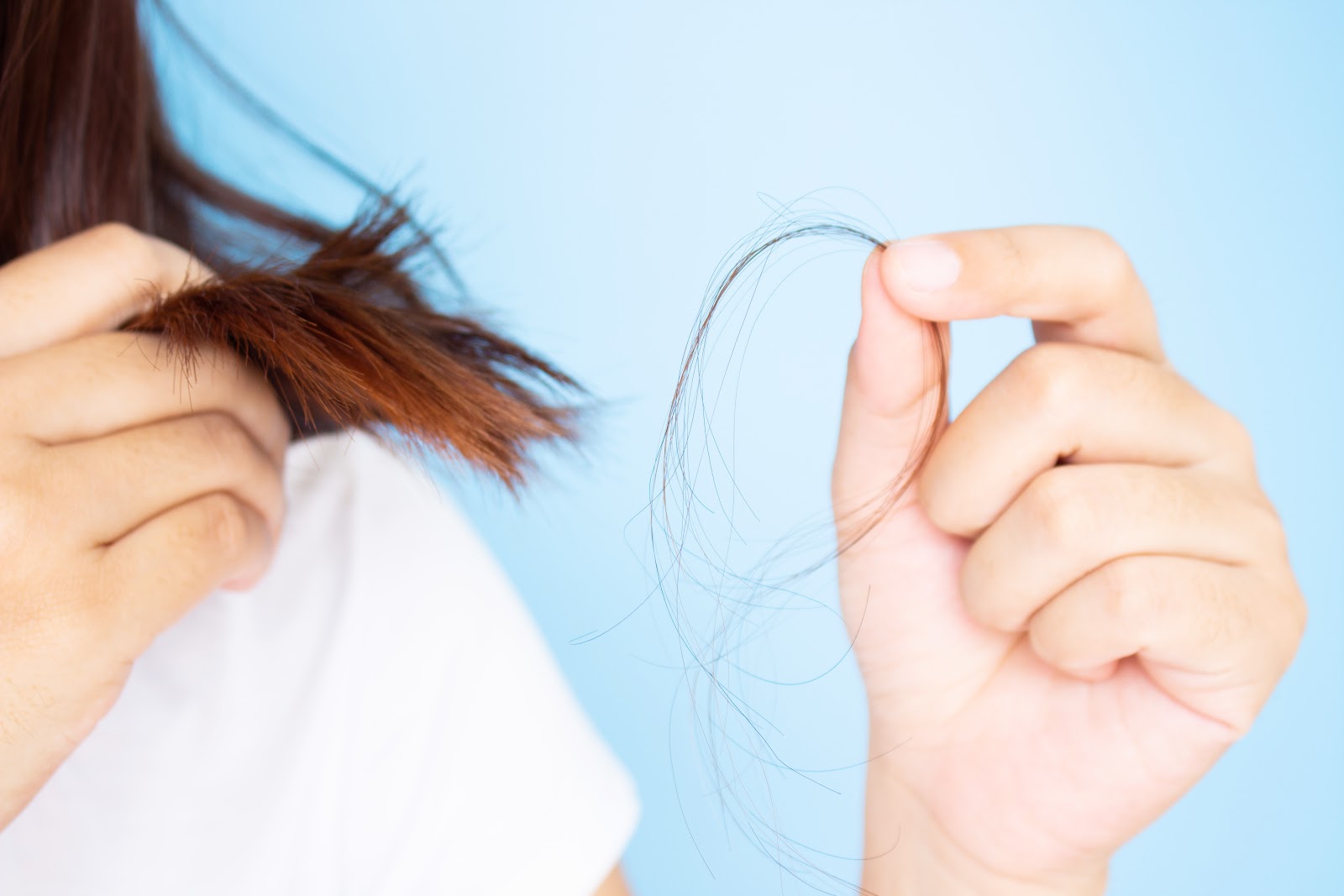 Hair Loss in Pregnancy | Doctor-4-U